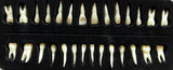 Teeth